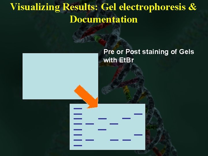 Visualizing Results: Gel electrophoresis & Documentation Pre or Post staining of Gels with Et.