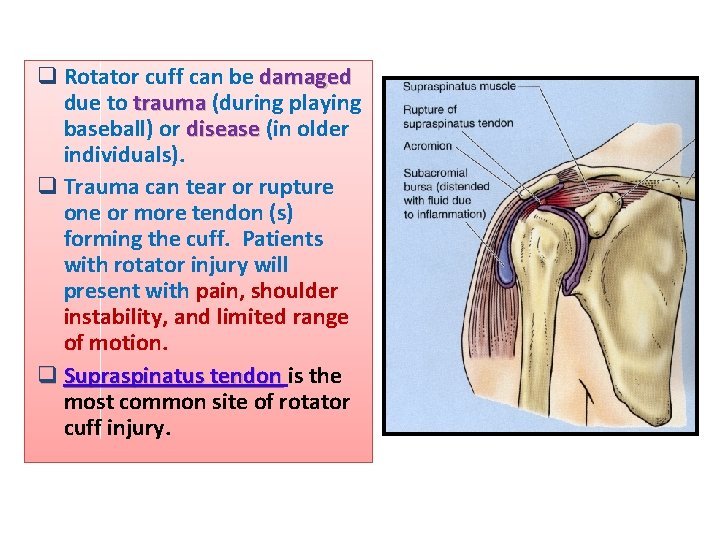 q Rotator cuff can be damaged due to trauma (during playing baseball) or disease