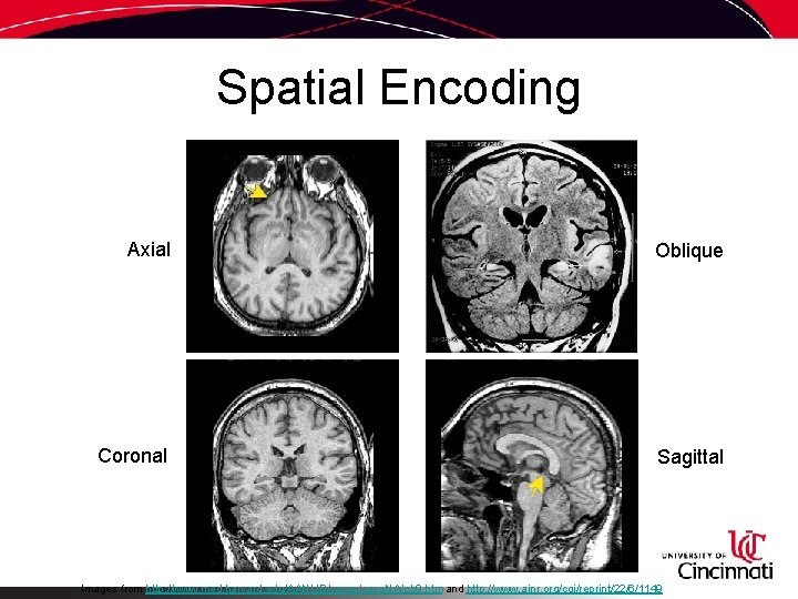 Spatial Encoding Axial Oblique Coronal Sagittal Images from http: //www. med. harvard. edu/AANLIB/cases/case. NA/pb