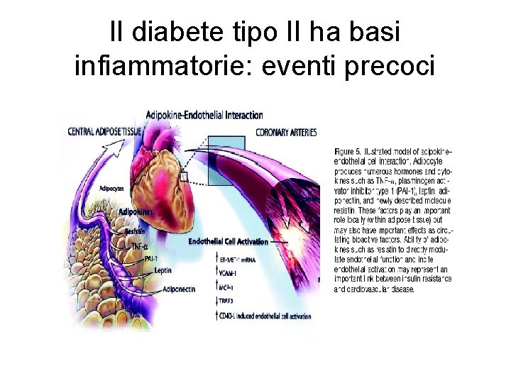 Il diabete tipo II ha basi infiammatorie: eventi precoci 