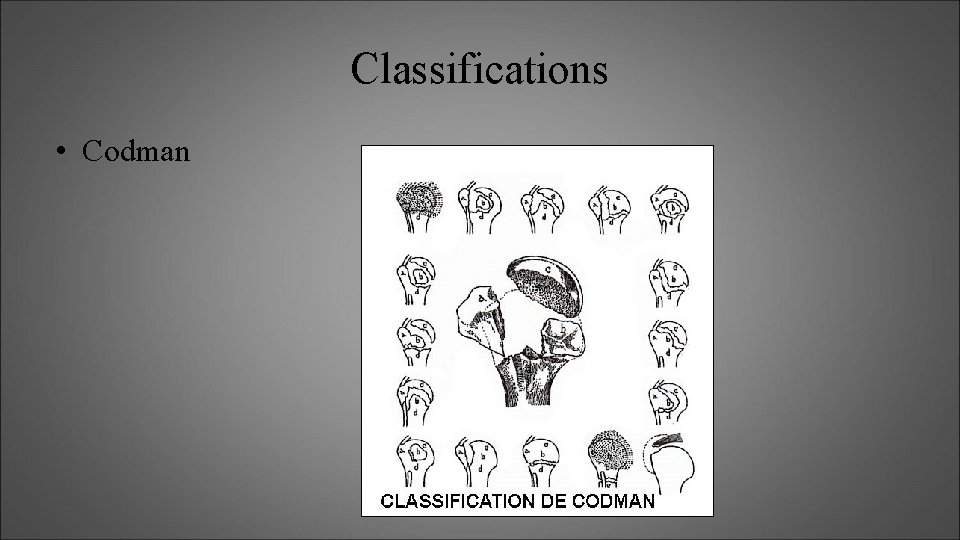 Classifications • Codman 
