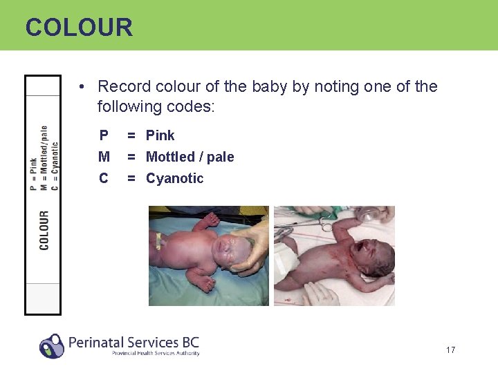 COLOUR • Record colour of the baby by noting one of the following codes: