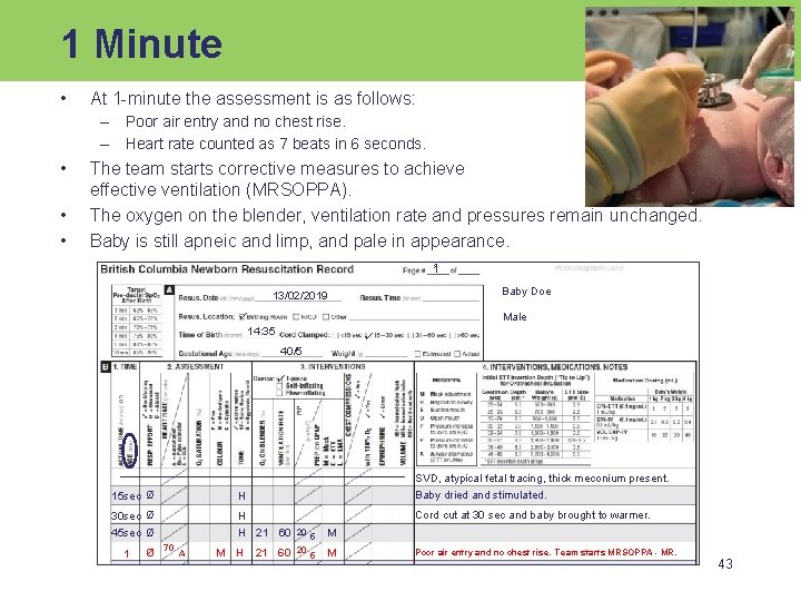 1 Minute • At 1 -minute the assessment is as follows: – Poor air