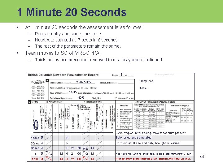 1 Minute 20 Seconds • At 1 -minute 20 -seconds the assessment is as
