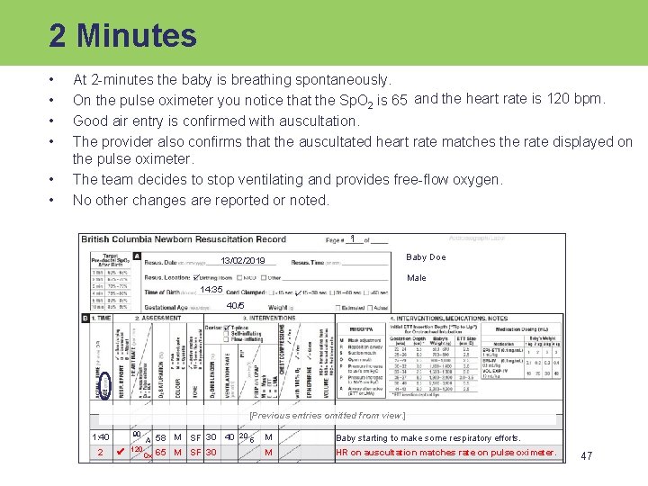 2 Minutes • • • At 2 -minutes the baby is breathing spontaneously. On