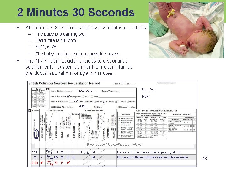 2 Minutes 30 Seconds • At 2 -minutes 30 -seconds the assessment is as