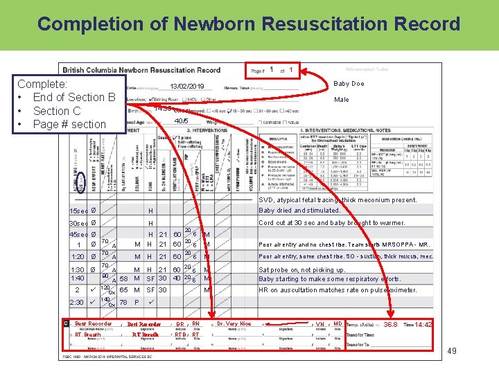 Completion of Newborn Resuscitation Record 1 1 Complete: • End of Section B •