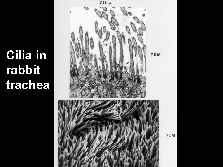 Cilia in rabbit trachea Cilia in rabbit trachea