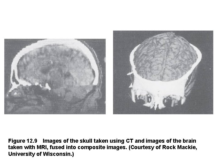 Figure 12. 9 Images of the skull taken using CT and images of the brain