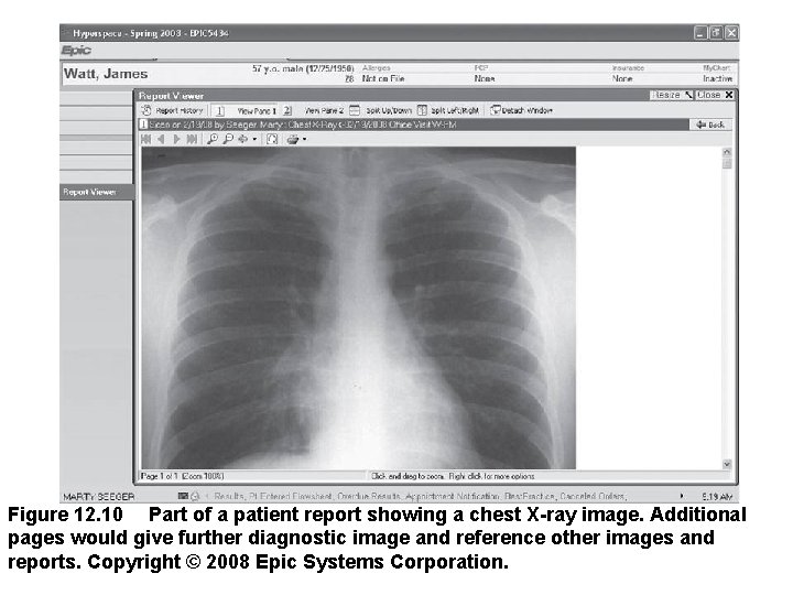 Figure 12. 10  Part of a patient report showing a chest X-ray image. Additional