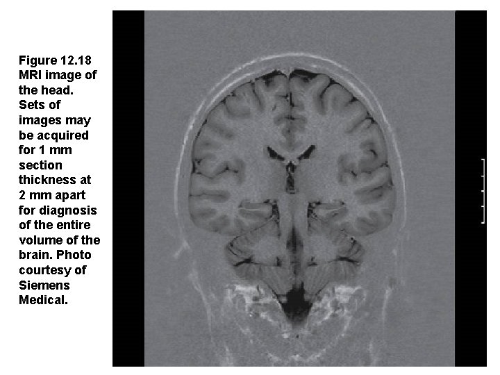 Figure 12. 18  MRI image of the head. Sets of images may be acquired