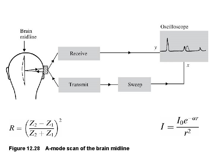 Figure 12. 28 A-mode scan of the brain midline 