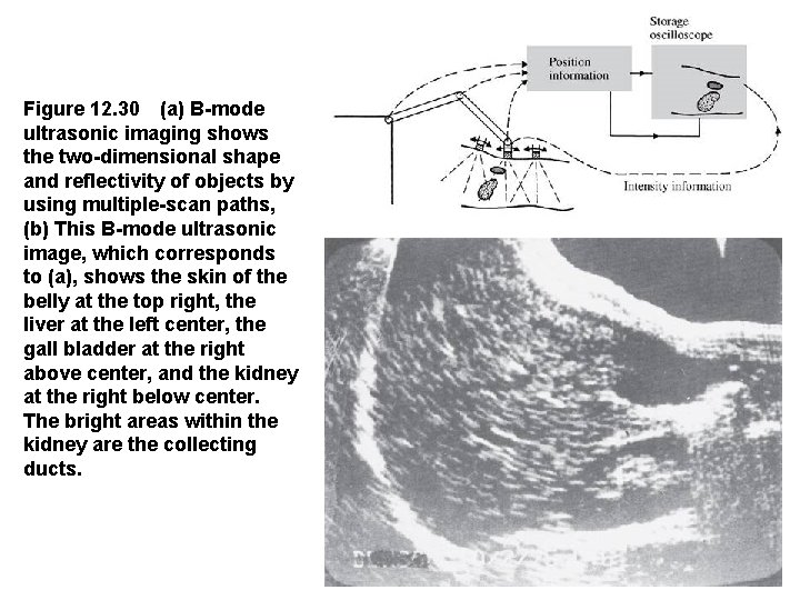 Figure 12. 30 (a) B-mode ultrasonic imaging shows the two-dimensional shape and reflectivity of objects