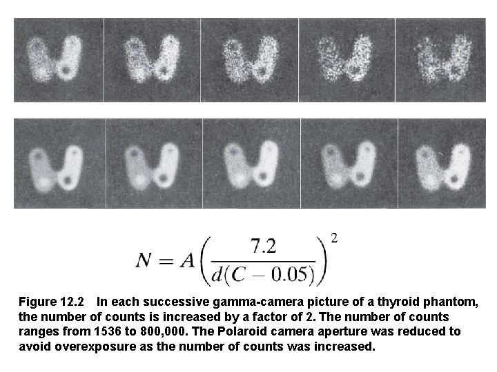 Figure 12. 2 In each successive gamma-camera picture of a thyroid phantom, the number of