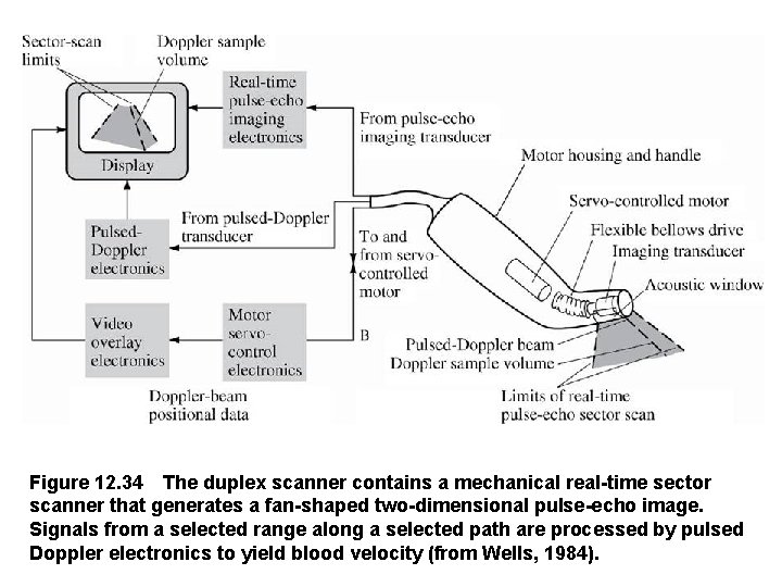 Figure 12. 34 The duplex scanner contains a mechanical real-time sector scanner that generates a