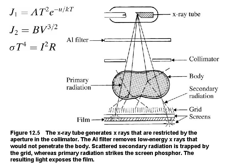 Figure 12. 5 The x-ray tube generates x rays that are restricted by the aperture