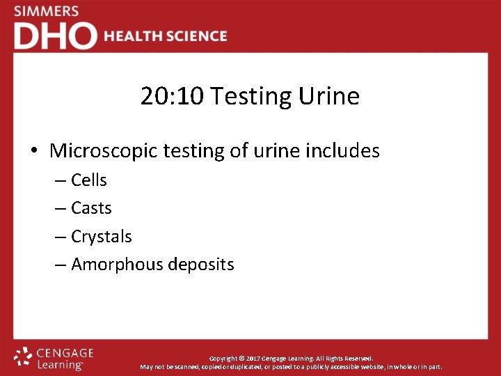 20: 10 Testing Urine • Microscopic testing of urine includes – Cells – Casts