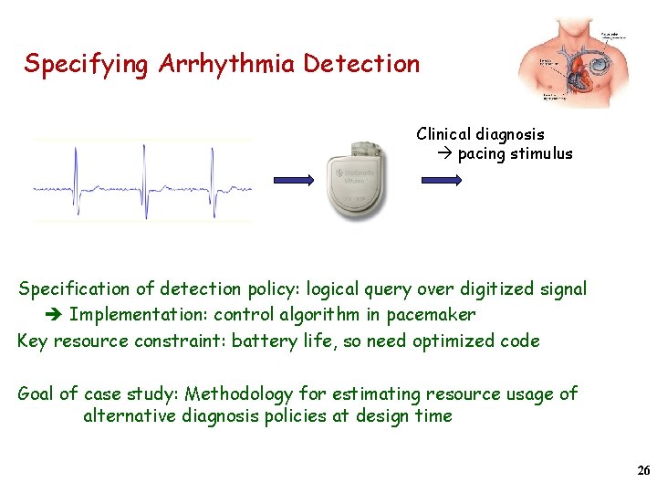 Specifying Arrhythmia Detection Clinical diagnosis pacing stimulus Specification of detection policy: logical query over
