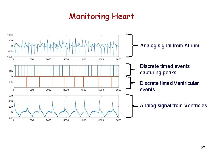 Monitoring Heart Analog signal from Atrium Discrete timed events capturing peaks Discrete timed Ventricular