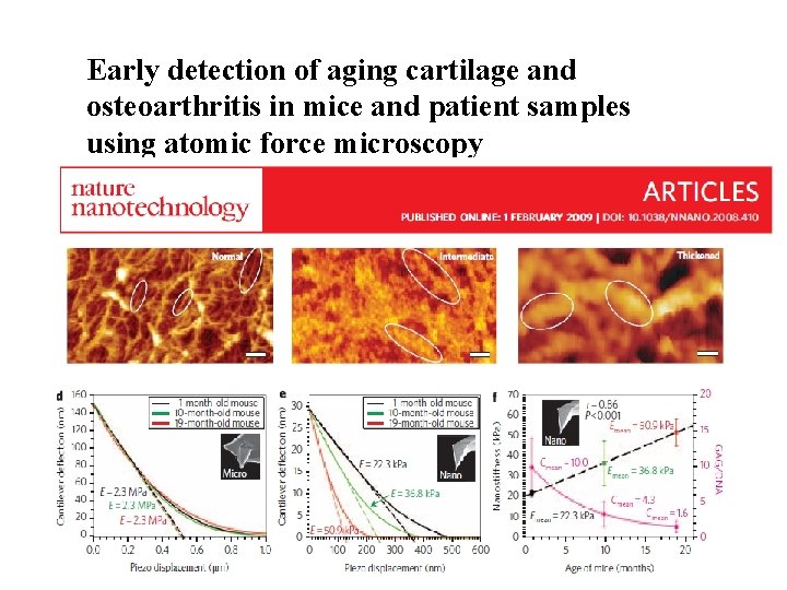 Early detection of aging cartilage and osteoarthritis in mice and patient samples using atomic