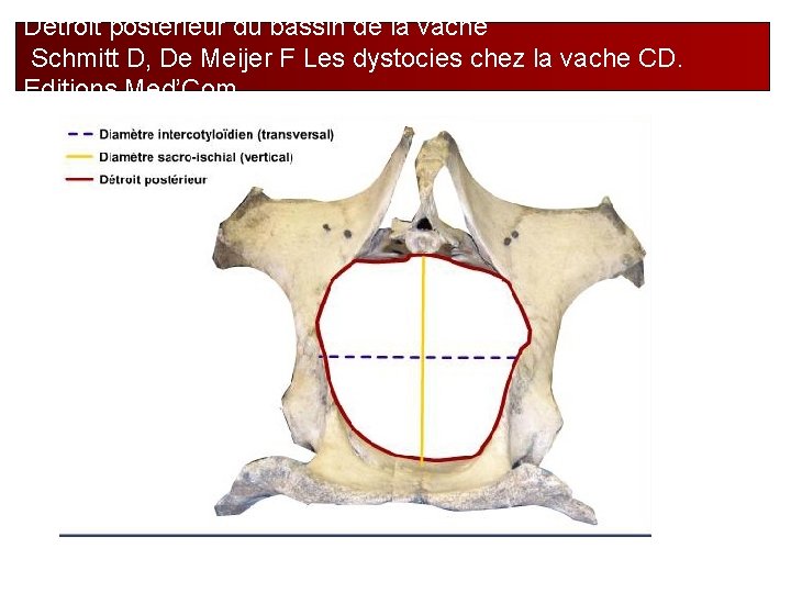 Détroit postérieur du bassin de la vache Schmitt D, De Meijer F Les dystocies