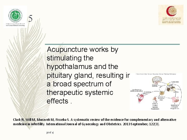 5 Acupuncture works by stimulating the hypothalamus and the pituitary gland, resulting in a