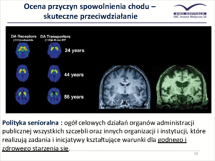 Ocena przyczyn spowolnienia chodu – skuteczne przeciwdziałanie Polityka senioralna : ogół celowych działań organów