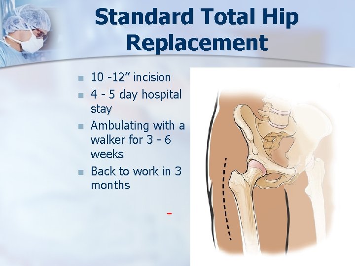 Standard Total Hip Replacement n n 10 -12” incision 4 - 5 day hospital