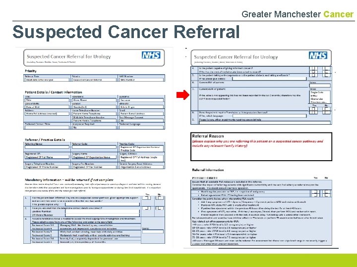 Greater Manchester Cancer Suspected Cancer Referral 