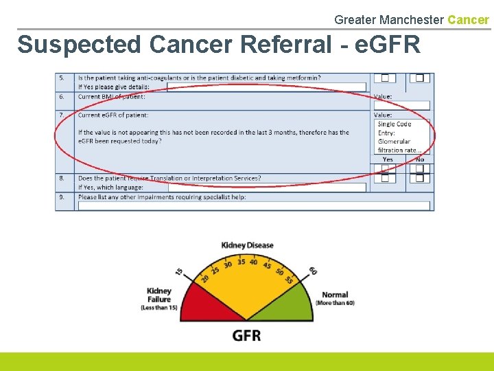 Greater Manchester Cancer Suspected Cancer Referral - e. GFR 