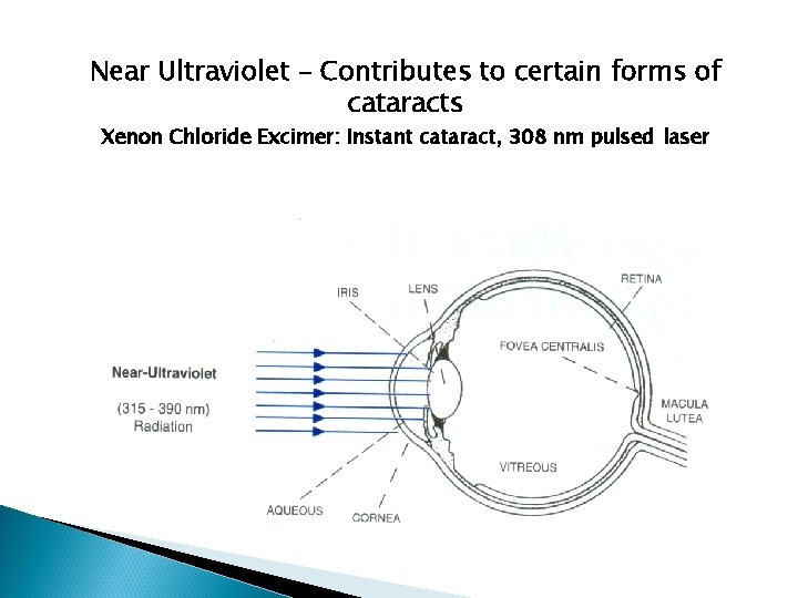 Near Ultraviolet – Contributes to certain forms of cataracts Xenon Chloride Excimer: Instant cataract,