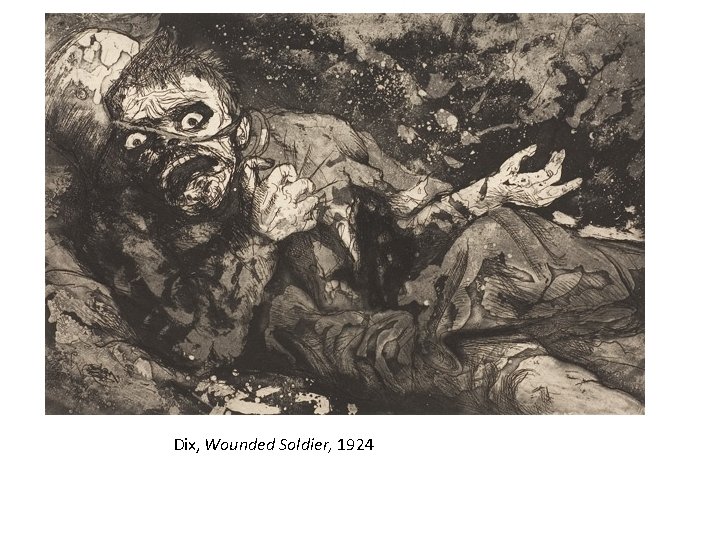 Dix, Wounded Soldier, 1924 