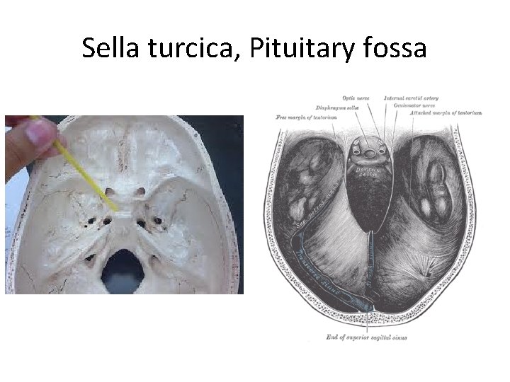 Sella turcica, Pituitary fossa 