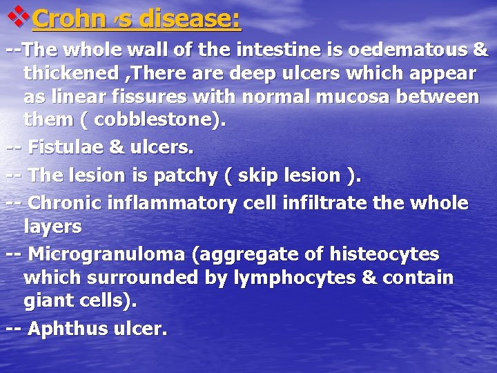 v. Crohn , s disease: --The whole wall of the intestine is oedematous &