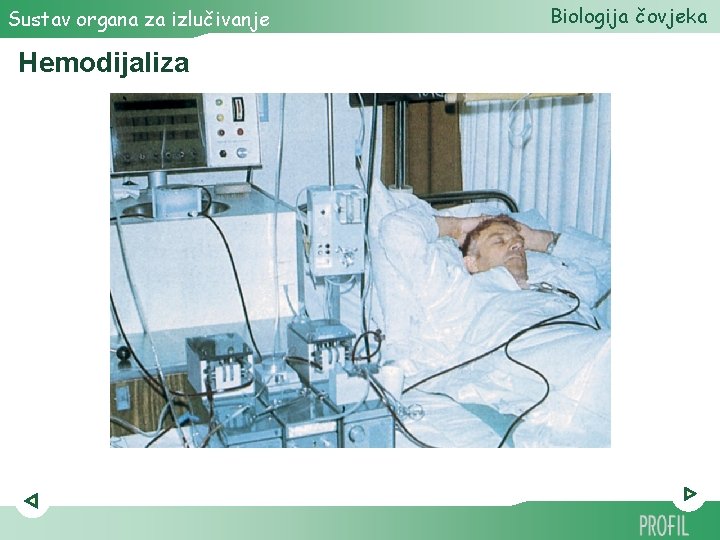 Sustav organa za izlučivanje Hemodijaliza Biologija čovjeka 