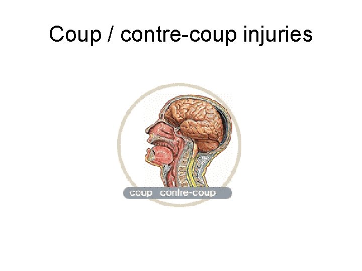 Coup / contre-coup injuries 