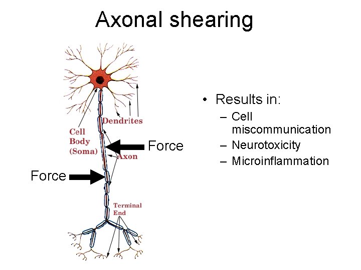 Axonal shearing • Results in: Force – Cell miscommunication – Neurotoxicity – Microinflammation 