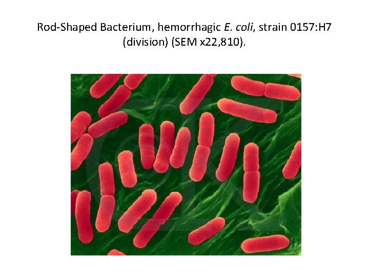 Rod-Shaped Bacterium, hemorrhagic E. coli, strain 0157: H 7 (division) (SEM x 22, 810).