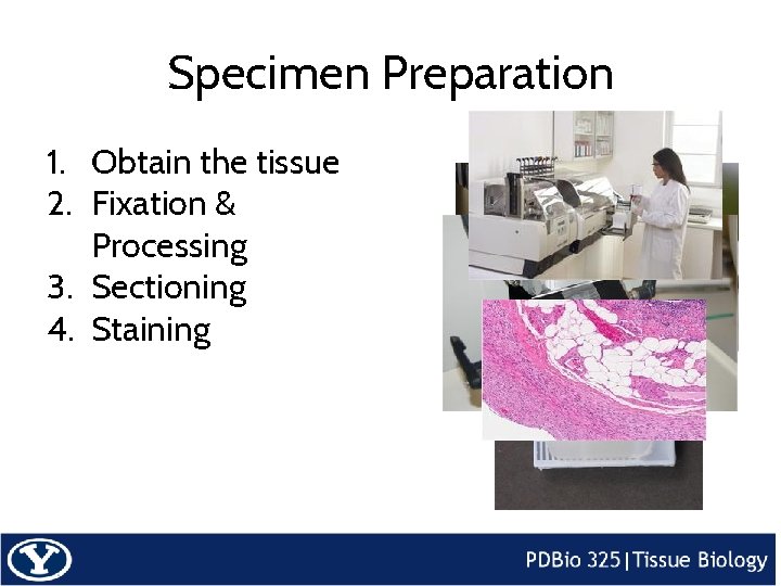 Specimen Preparation 1. Obtain the tissue 2. Fixation & Processing 3. Sectioning 4. Staining