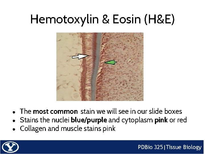 Hemotoxylin & Eosin (H&E) ● ● ● The most common stain we will see
