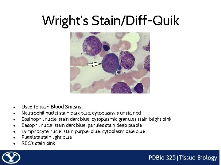 Wright’s Stain/Diff-Quik ● ● ● ● Used to stain Blood Smears Neutrophil nuclei stain