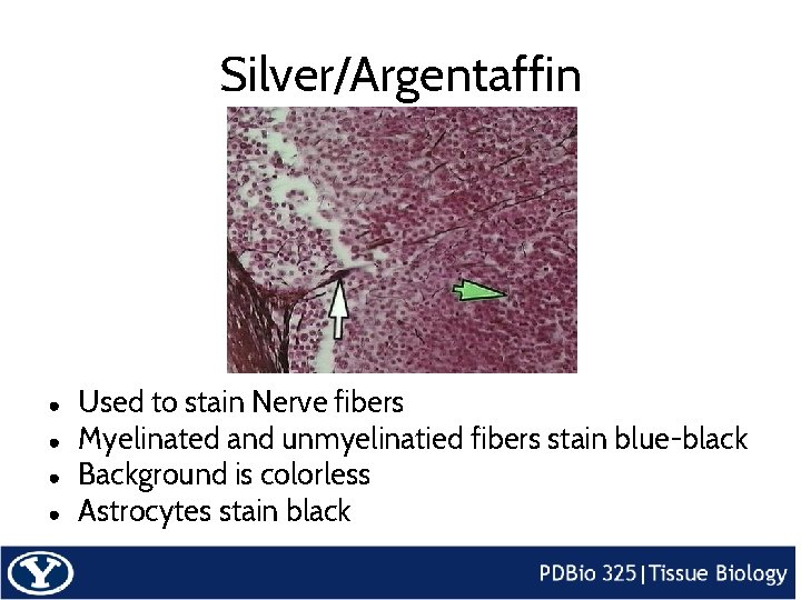 Silver/Argentaffin ● ● Used to stain Nerve fibers Myelinated and unmyelinatied fibers stain blue-black