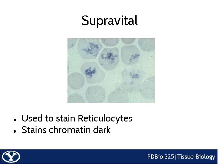 Supravital ● ● Used to stain Reticulocytes Stains chromatin dark 