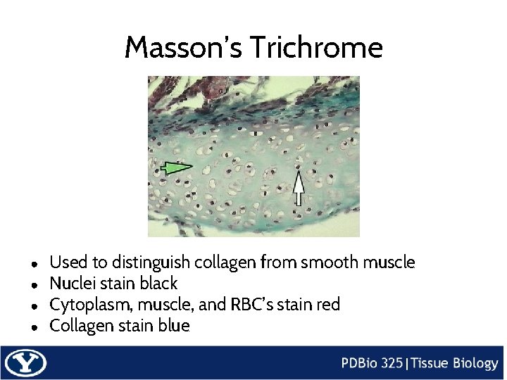 Masson’s Trichrome ● ● Used to distinguish collagen from smooth muscle Nuclei stain black