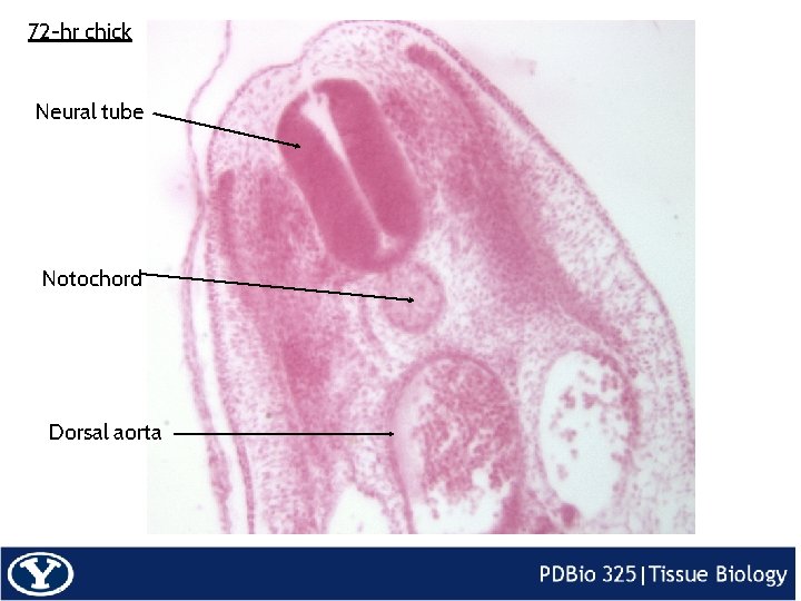 72 -hr chick Neural tube Notochord Dorsal aorta 