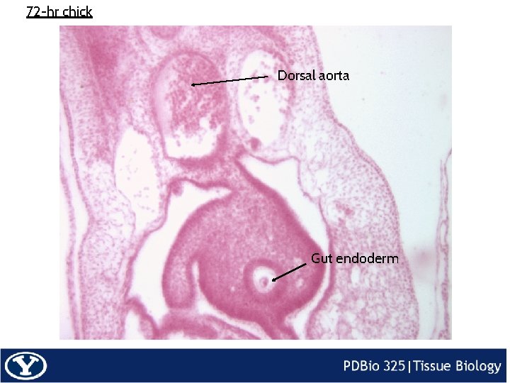 72 -hr chick Dorsal aorta Gut endoderm 