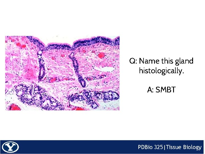 Q: Name this gland histologically. A: SMBT 