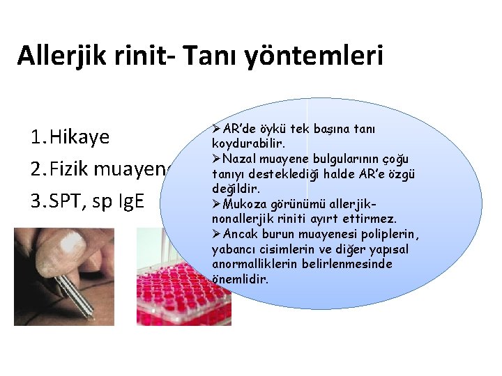 Allerjik rinit- Tanı yöntemleri 1. Hikaye 2. Fizik muayene 3. SPT, sp Ig. E