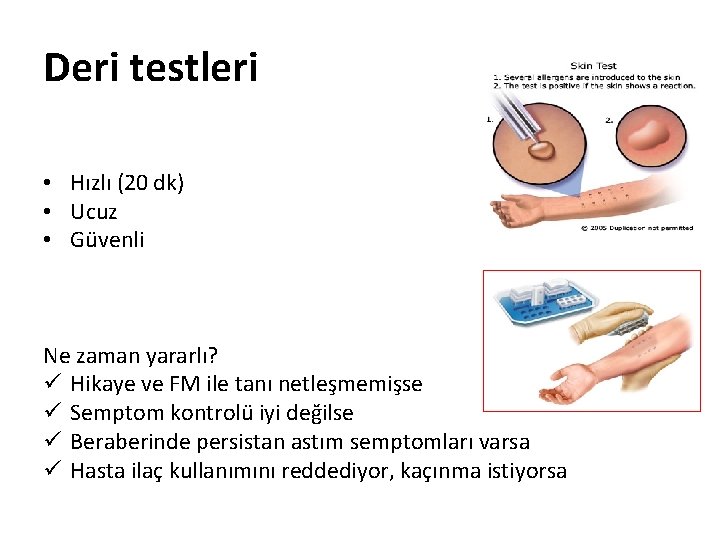 Deri testleri • Hızlı (20 dk) • Ucuz • Güvenli Ne zaman yararlı? ü