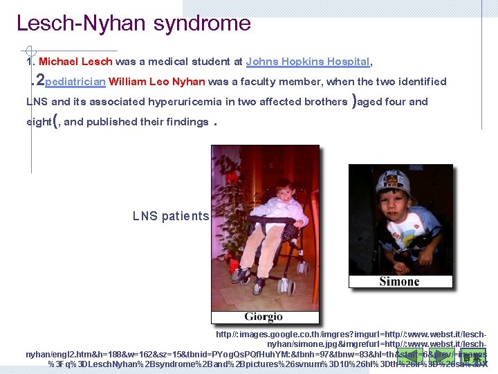 Lesch-Nyhan syndrome 1. Michael Lesch was a medical student at Johns Hopkins Hospital, .